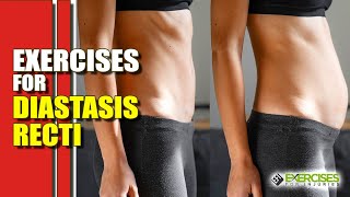 Exercises for Diastasis Recti [upl. by Ahsemaj121]