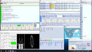 Ham Radio  40 Meter RTTY QSO in the ARRLY RTTY Roundup [upl. by Aeresed]