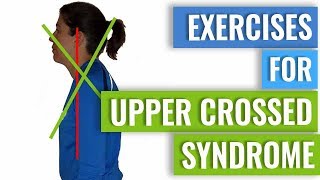 Exercises to Correct Upper Crossed Syndrome [upl. by Yeloc]