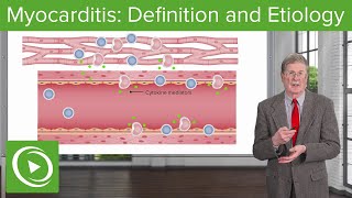 What is Myocarditis and What Causes It [upl. by Emory]