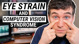 5 Tips and Eye Exercises for EYE STRAIN Relief [upl. by Isabelita]