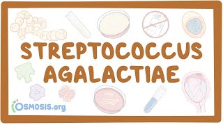 Streptococcus agalactiae group B strep  an Osmosis Preview [upl. by Felicia876]