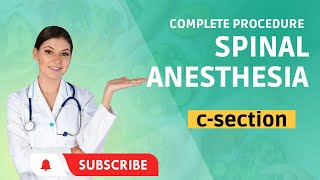 Spinal Anesthesia Procedure [upl. by Anahpos864]