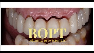 BOPT Provisional Relining  HOW TO [upl. by Zel]