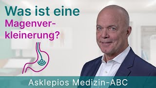 Was ist eine Magenverkleinerung  Medizin ABC  Asklepios [upl. by Laband855]