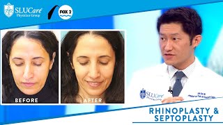 Rhinoplasty vs Septoplasty Better Breathing and Reshaping the Nose  Fox 2 [upl. by Horter]