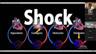 Cardiogenic shock AMC [upl. by Adnicul746]