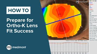 HowTo  Prepare for OrthoK lens fit success [upl. by Feigin413]