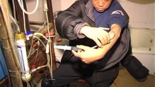 DoItYourself dialysis keeps man alive [upl. by Theda]