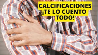 Calcificaciones 🦴 tendinosas te lo cuento TODO [upl. by Dnalloh]