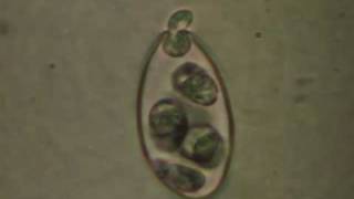 SOD Zoospores Emerging [upl. by Antrim]