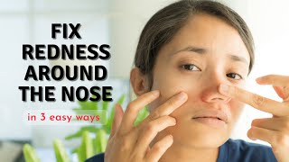 How to Fix Redness Around Nose in 3 Easy Ways [upl. by Notsruht914]