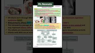 MrNeonate ❤️❤️ for NiCu physicians [upl. by Miza927]