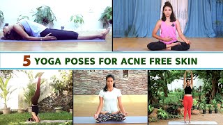 5 Yoga Poses For Acne Free Skin  Yoga For Acne Free Skin  Yoga For Skin  VentunoYoga [upl. by Marie-Jeanne]