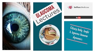 SECONDARY GLAUCOMA part 2 lens hematogenic and psudoexfoliative glaucoma [upl. by Eelhsa]