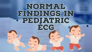 Normal findings in Pediatrics ECG  How to read ECG in children [upl. by Artinahs]