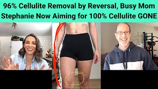 96 Cellulite Removal for Busy Mom w Health amp BodyComposition Improvements to Get Rid of Cellulite [upl. by Attiuqal102]