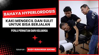 BAHAYA HYPERLORDOSIS I Terapi By Ahong [upl. by Quintina]