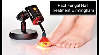 Pact Fungal Nail Treatment Birmingham [upl. by Anemolif]