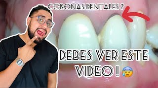 Coronas dentales¿tienes una DEBES VER ESTE VIDEO [upl. by Udell]