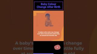 WHEN BABY SKIN COLOR CHANGE  shorts  Why do babies get darker after birth youtubeshorts [upl. by Murage]