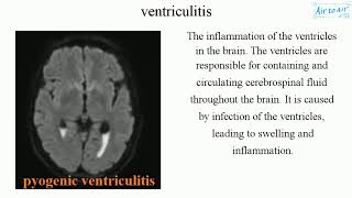 ventriculitis English  Medical terminology for medical students [upl. by Harrat534]