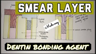 SMEAR LAYER  DENTIN BONDING AGENTS  DENTAL MATERIALS [upl. by Anikat126]