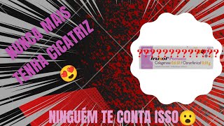 VLOG POMADA IRUXOL  colagenase e cloranfenicol [upl. by Sinnoda]