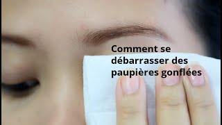 Comment se débarrasser des paupières gonflées [upl. by Ramyar210]