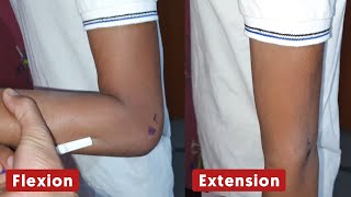 Movement of Elbow Joint  Flexion and Extension  The Charsi of Medical Literature [upl. by Aneehsram]