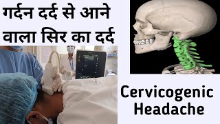 Cervicogenic headache II गर्दन दर्द से आने वाला सिर का दर्द II Pain management Dr Aanchal Sharma [upl. by Hibben334]