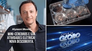 Jornal da Globo  Atvidade elétrica dos minicérebros [upl. by Aihsilef]