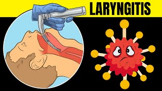 Laryngitis Acute amp Chronic  Causes Signs amp Symptoms Diagnosis And Treatment [upl. by Arakawa101]