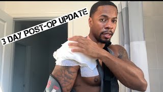 3 Day PostOp Labrum Tear Surgery [upl. by Gleason]