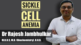 Sickle cell anemia [upl. by Diaz]