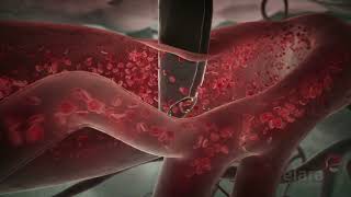 Malaria 3D Animation Shows How the Infection Spreads in the Body [upl. by Sherard]