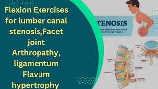 Flexion Exercises For lumber Canal stenosisFacet Joint Arthropathy ligamentum Flavum Hypertrophy [upl. by Gargan]