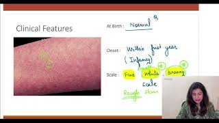 Ichthyosis Cause Clinical features Diagnosis amp Treatment  Disorder of Keratinisation Dr Pallavi [upl. by Vanya]