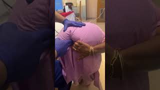 Chiropractor Treatment For Heavy Tailbone Pain mumbai delhi [upl. by Enom]