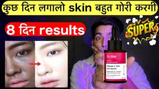 कुछ दिन में स्किन बहुत गोरी  Dr alies vitamin c serum  Dr alies vitamin c serum review  Dr alies [upl. by Hehre]