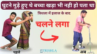 मेरा सेरेब्रल पाल्सी से प्रभावित बच्चा अब चल पा रहा है  Crouch Gait Pediatrics  Trishla foundation [upl. by Malone]