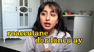 roaccutane dördüncü ay güncellemesi [upl. by Srini]