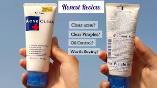 Honest Review of Mistine Acne Clear Face wash  Affordable Facewash for acne prone skin [upl. by Ahron]