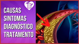 DISLIPIDEMIA Tipos Sintomas e Valores de Referência [upl. by Viviana]