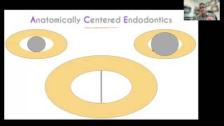 CE Webinar Anatomically Centered Endodontics with Dr Chafic Safi [upl. by Kiyohara]