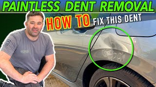 DENTS No Problem Watch the BEST Step by Step Guide On PDR [upl. by Gomar]