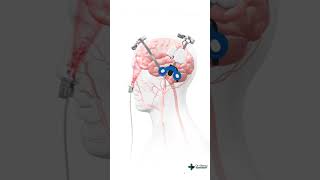 Brain 3D animation  Learn easy anatomy [upl. by Dnomaj600]