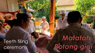 Tooth filing ceremony  Matatah  Upacara Potong Gigi [upl. by Mendelson]