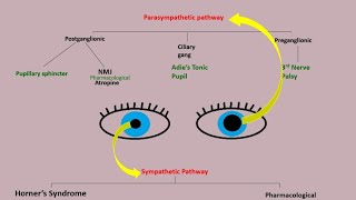 Anisocoria  evaluation of anisocoria  examination part 1 Approach to Anisocoria algorithm [upl. by Evadnee]