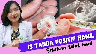 13 Tanda Positif Hamil sebelum Telat Haid  dr Emasuperr [upl. by Einiar682]